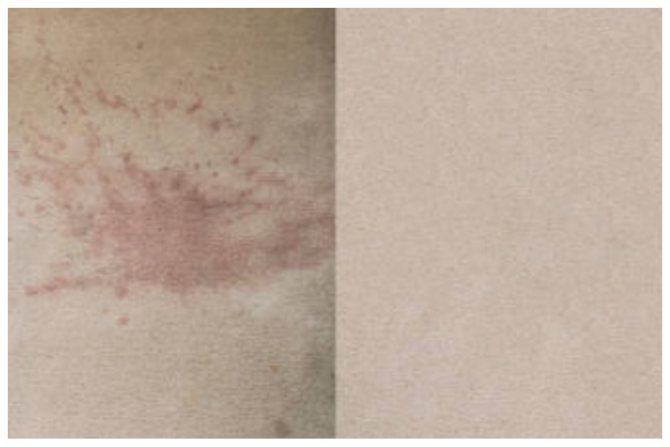 Удаление пятен